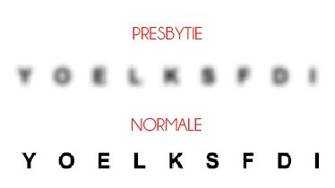 La presbytie